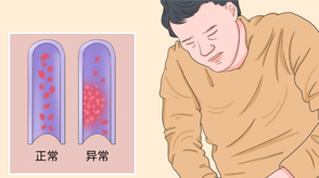 VTE的危害您了解嗎？