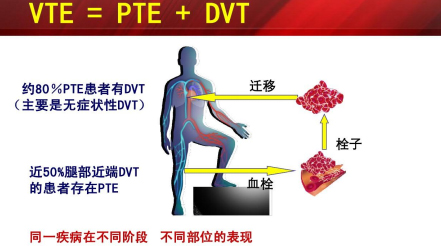 什么是臨床上一致公認的VTE防治基礎(chǔ)？