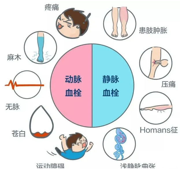 2022世界血栓日：就醫(yī)有新路，血栓找介入