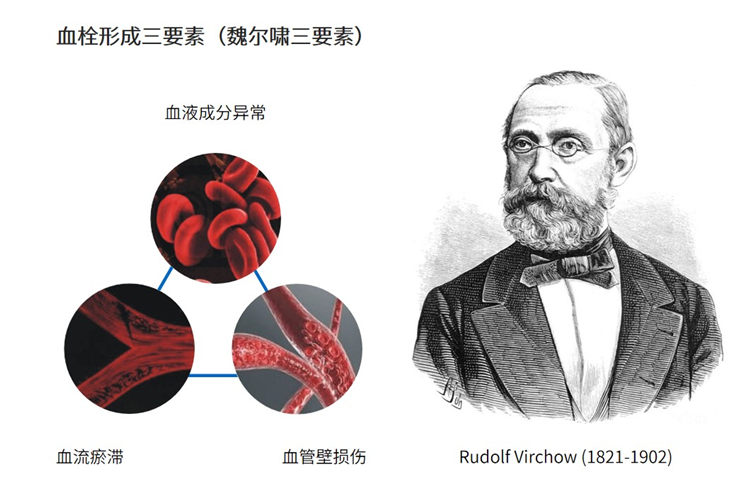 世界血栓日 | 拴不住，動起來