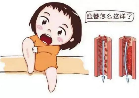 腫瘤不容忽視的第二號殺手—VTE，該如何防治？