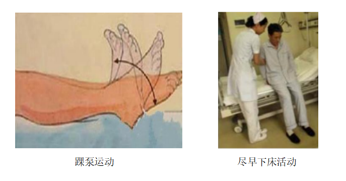圍術期患者VTE的預防，只知道抗凝可不行