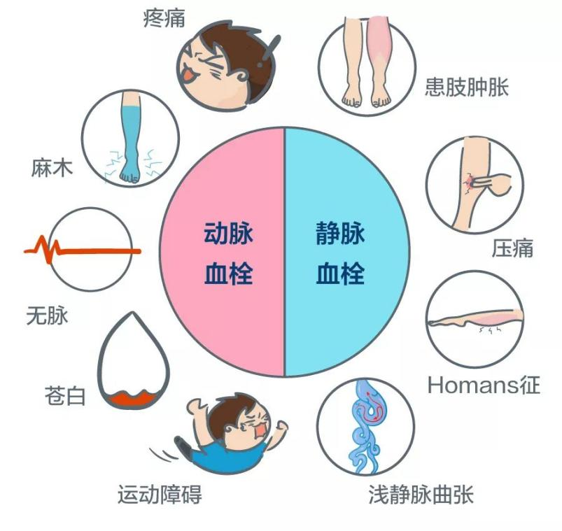 深靜脈血栓能致命，防治“大法”要了解！