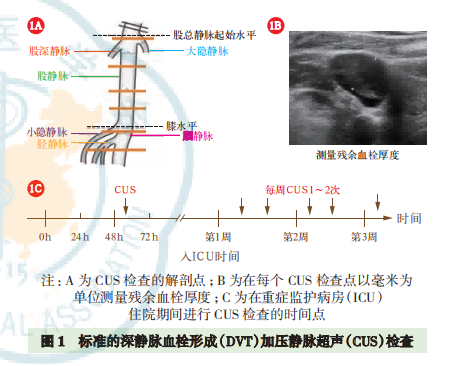 老年重癥患者靜脈血栓栓塞癥預防中國專家共識（2023）