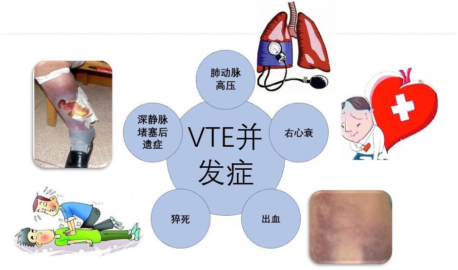 VTE的危害您了解嗎？